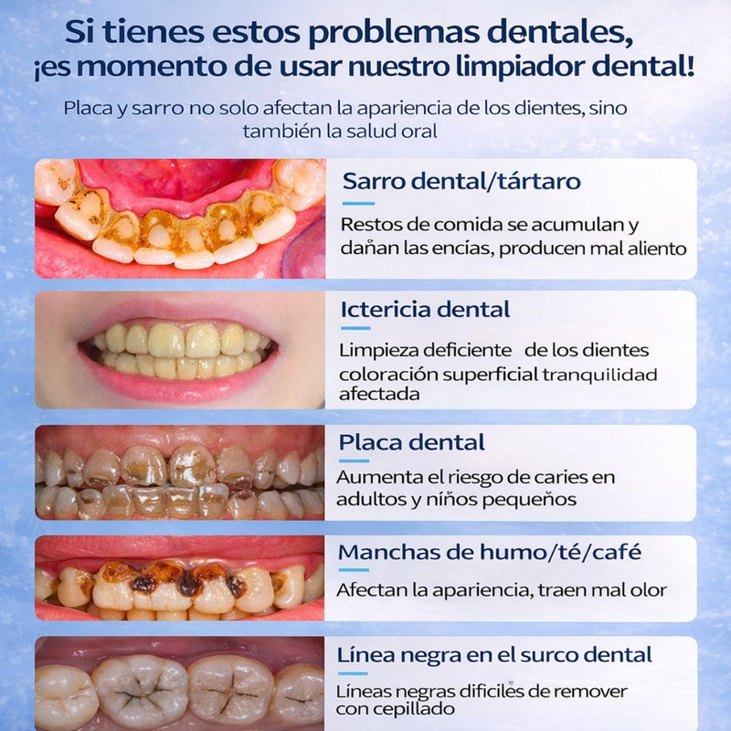 Limpiador Dental Ultrasónico Eléctrico Recargable con Pantalla LED. Removedor Bucal de Sarro y Placa Con 5 Modos de Limpieza, Impermeable IPX6 (Incluye 6 Cabezales)